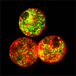 KG1_topodist